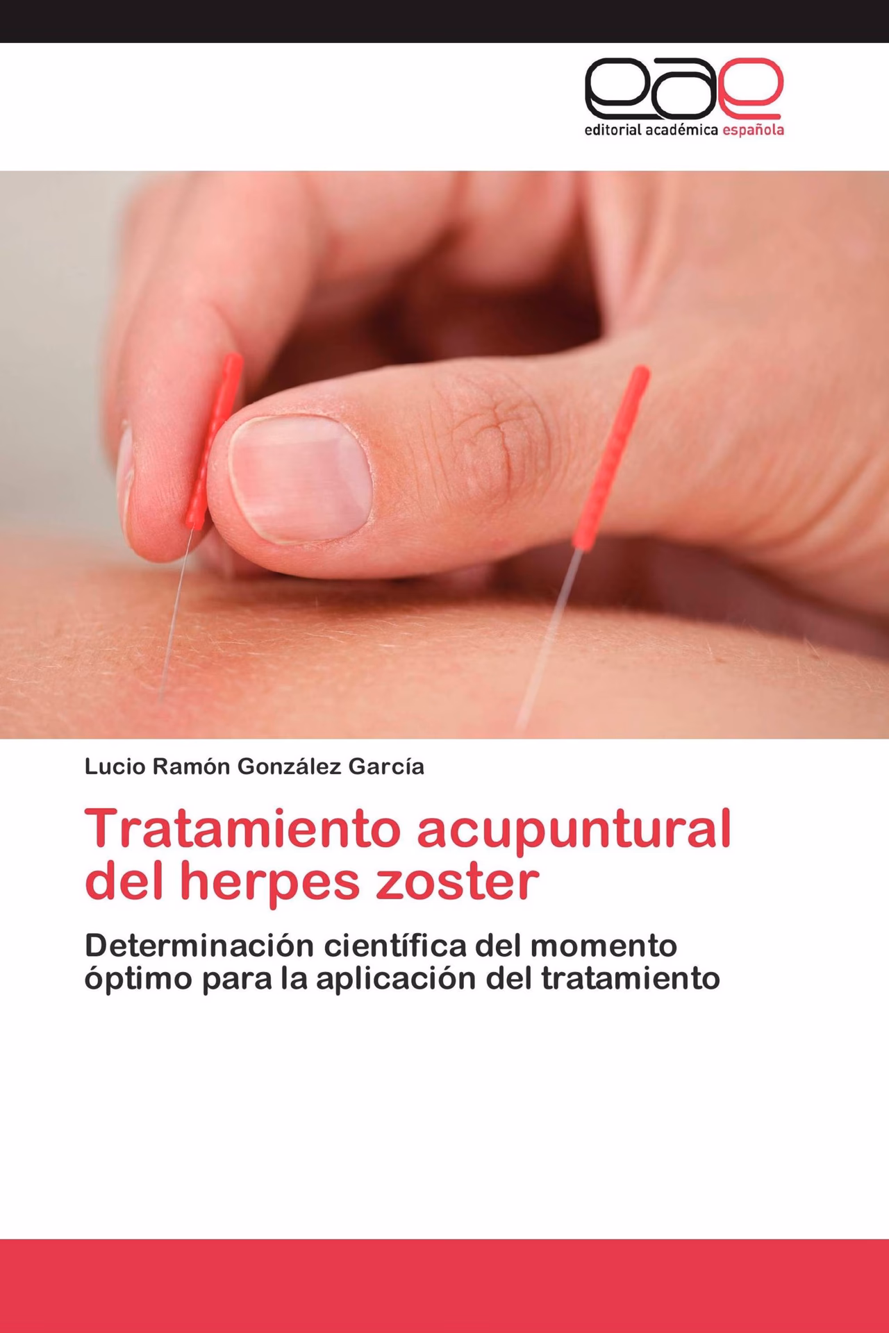 ¿Cuál es la forma más rápida de curar el herpes?