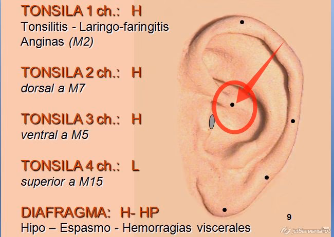 ¿Dónde presionar para que se vaya el hipo?