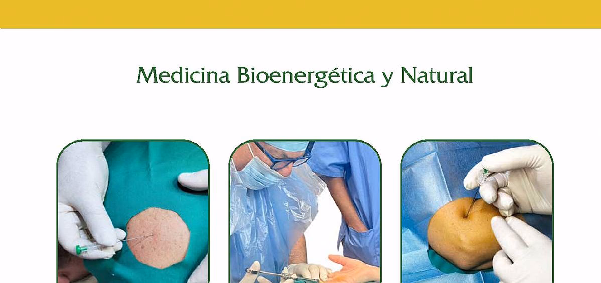 ¿Qué es el catgut en acupuntura?