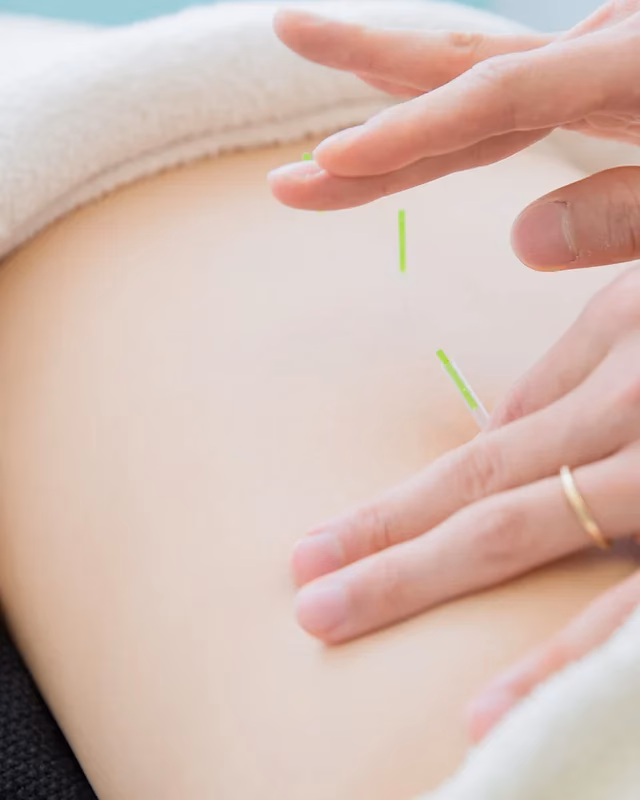 ¿Se practica la acupuntura en Japón?