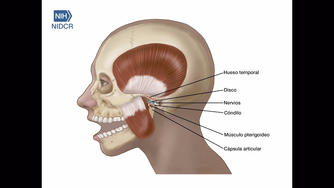 ¿Qué es la sinovitis mandibular?
