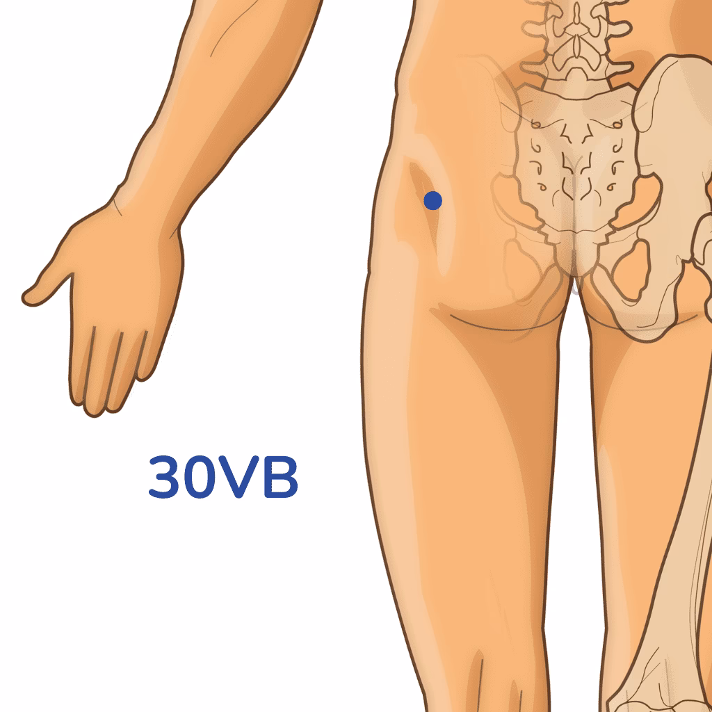 ¿Qué órgano puede causar dolor del nervio ciático?