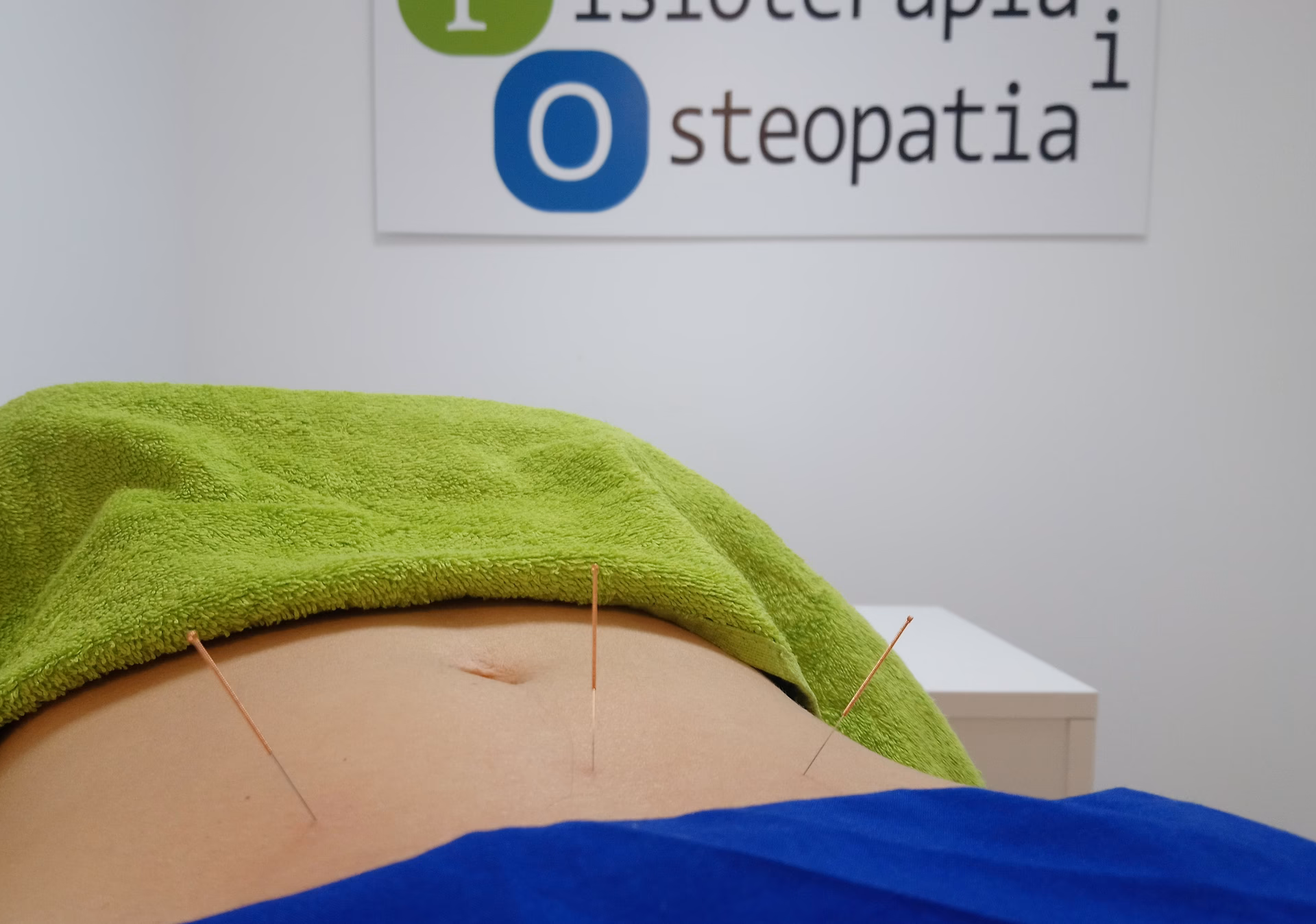 ¿Puede la acupuntura ayudar con el sangrado menstrual?