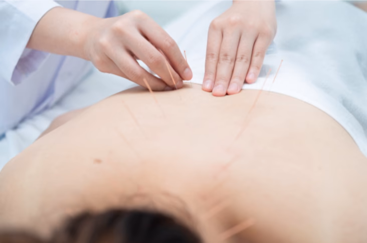 ¿Cuál es el mejor tratamiento para la fibromialgia?