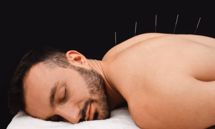 ¿Qué hay de cierto en la acupuntura?