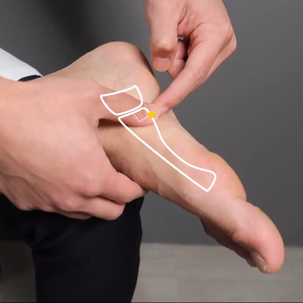 Does electroacupuncture work?