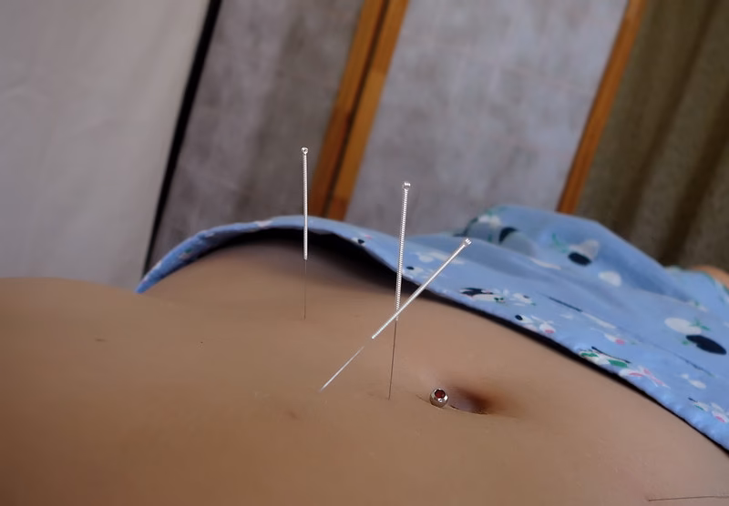 Can acupuncture get rid of belly fat?