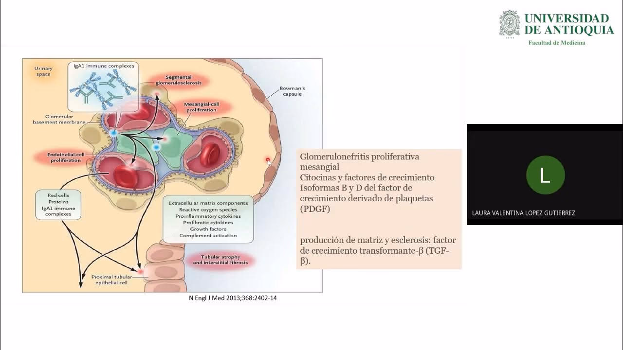 ¿Qué tomar para el IgA?