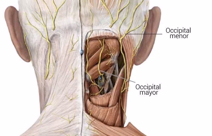 Can occipital neuralgia be treated with acupuncture?