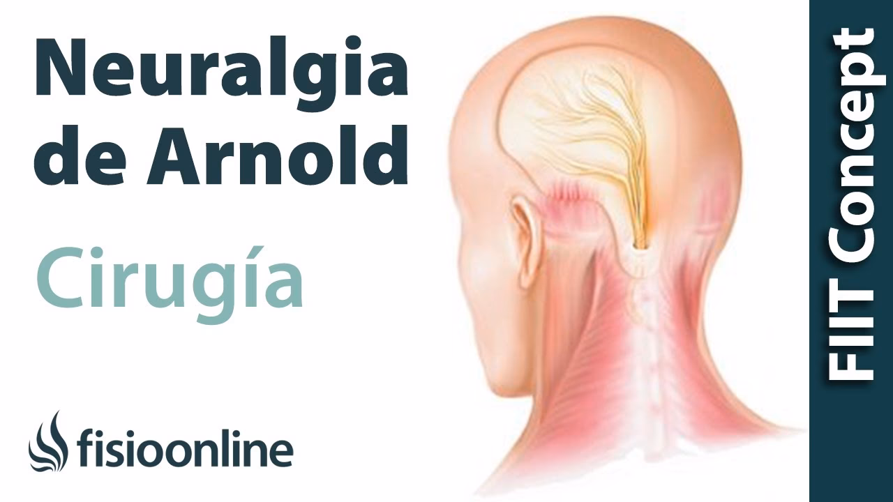 Can acupuncture cure neuralgia?