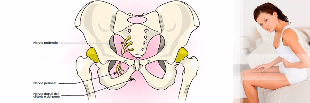 ¿Es buena la acupuntura para la neuralgia del pudendo?