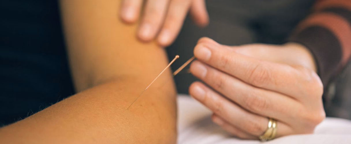 What is the high risk of acupuncture?