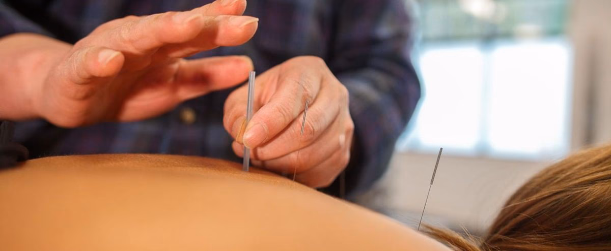 What is the high risk of acupuncture?