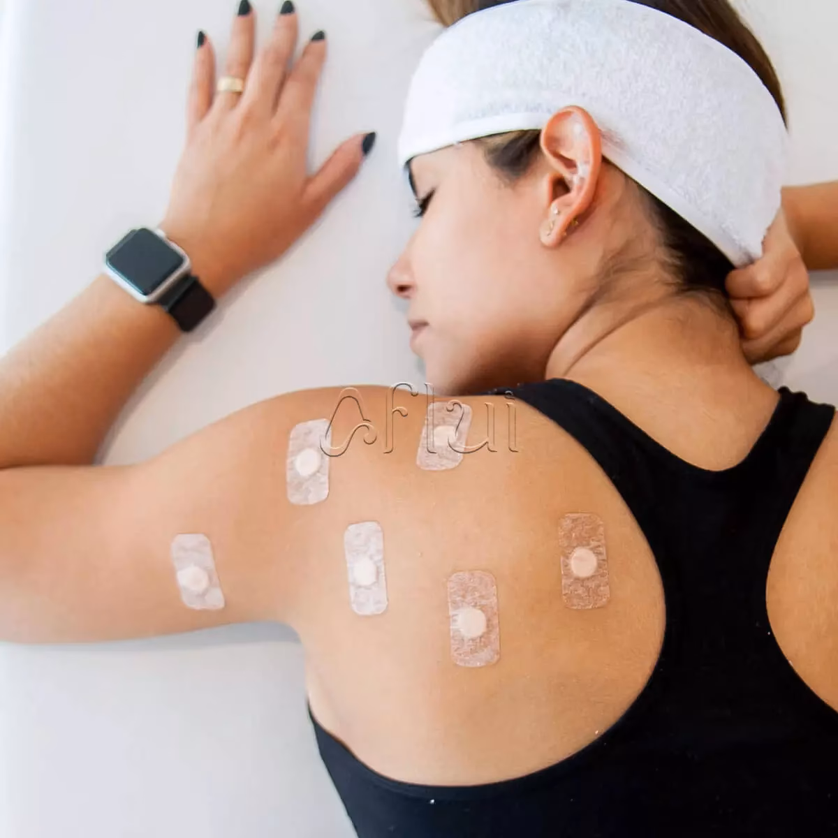 O que é o Stiper de acupuntura?