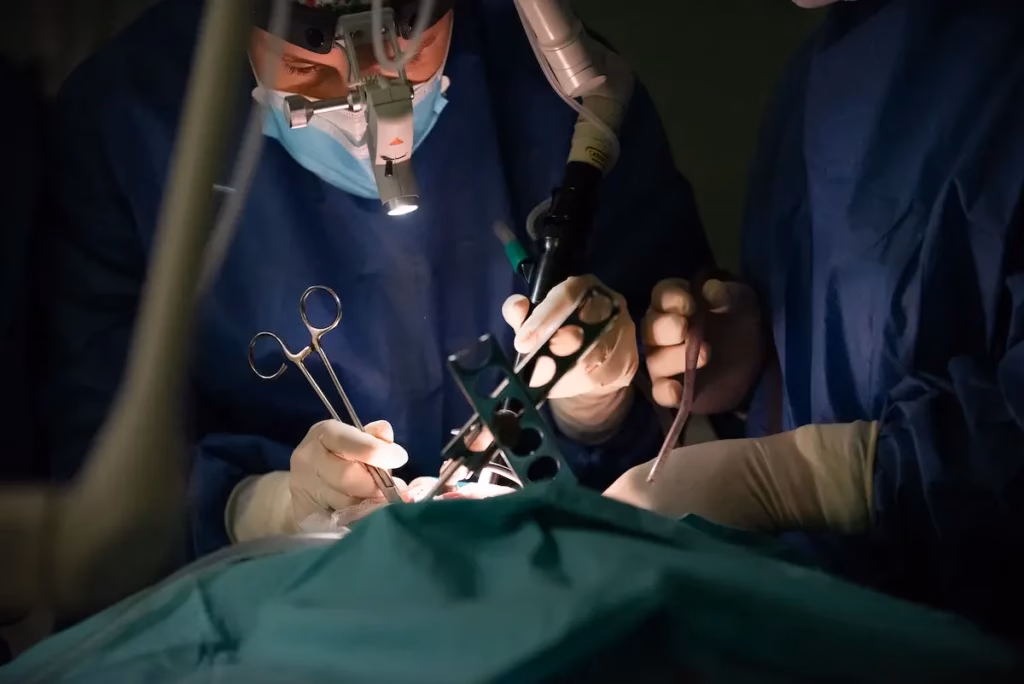 ¿Qué es bueno para eliminar los pólipos de la nariz?