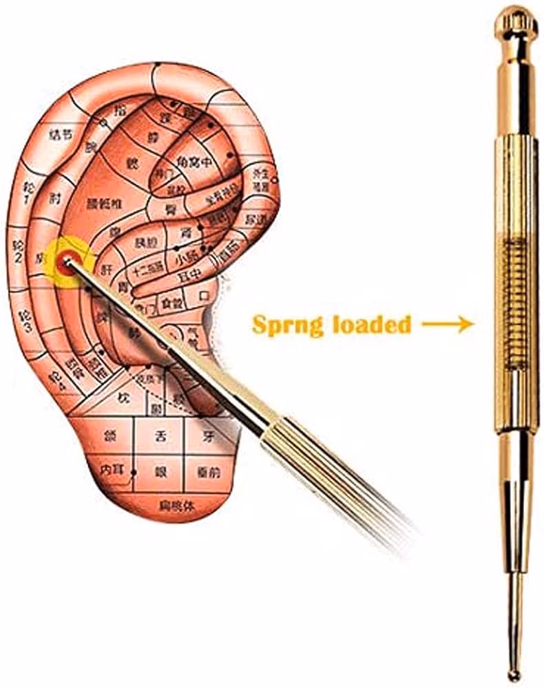 Do acupuncture seeds work?