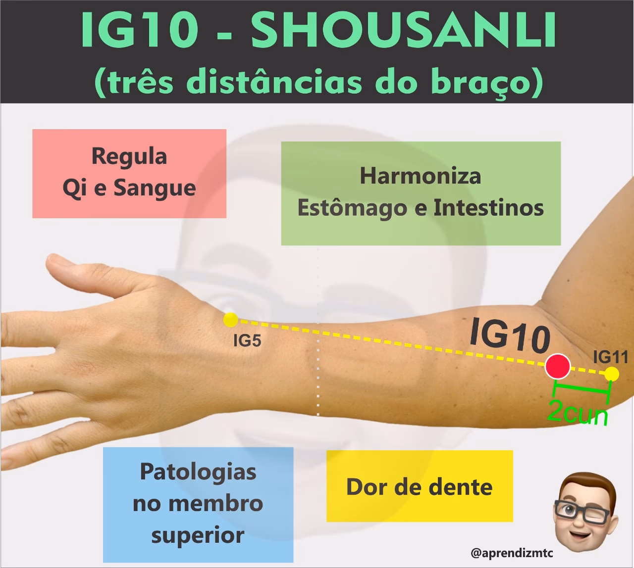 Onde é o ponto do intestino na acupuntura?