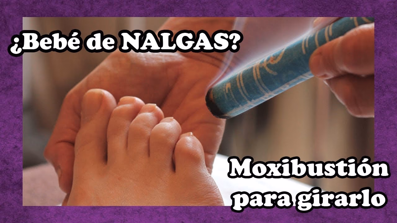 ¿Cómo es la maniobra para dar la vuelta al bebé?