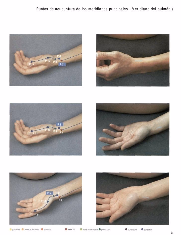 What is the Timmee acupuncture point?