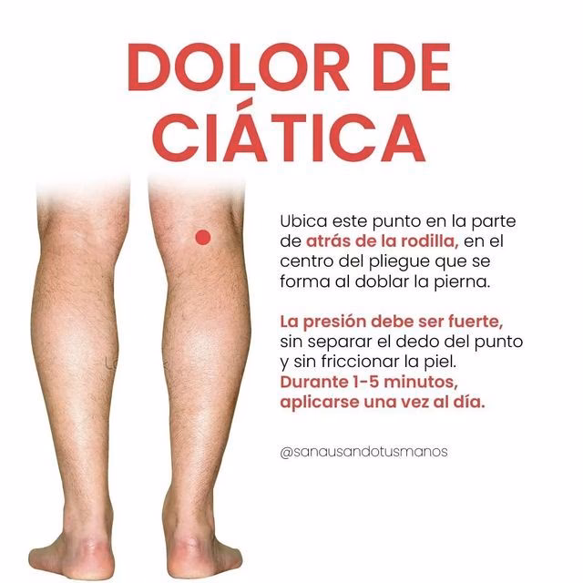 ¿Dónde se colocan las agujas de acupuntura para el dolor de ciática?
