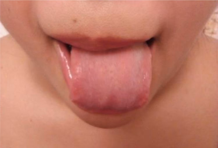 ¿Qué hacer para activar el páncreas?