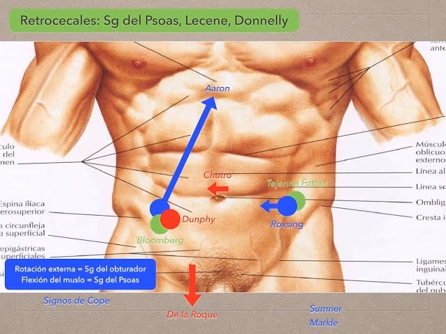 ¿Dónde presionar para la apendicitis?
