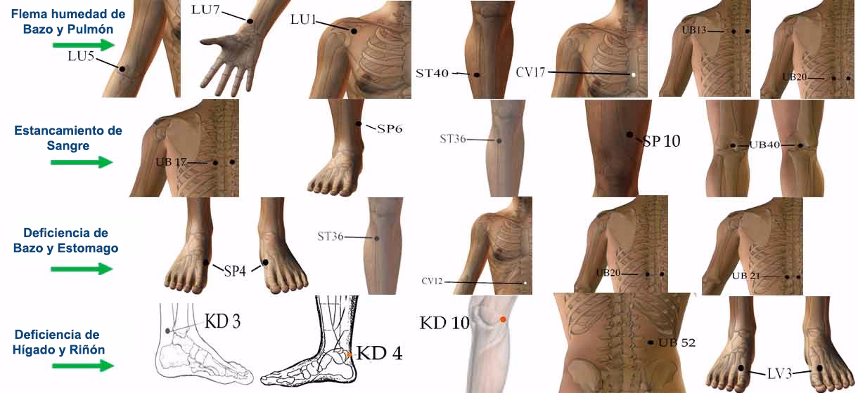 ¿Qué hierva cura el colesterol?