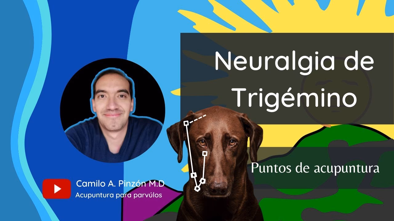 ¿Cómo desinflamar el nervio del trigémino?