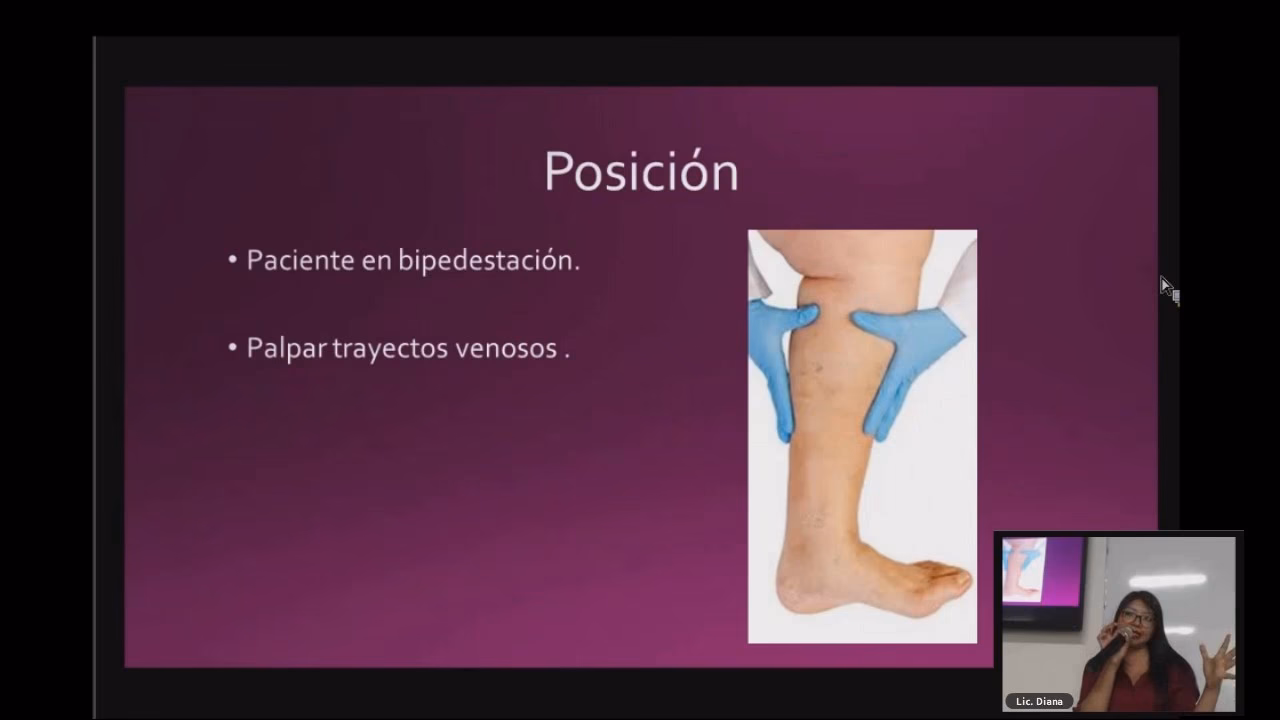 ¿Qué hierba es buena para la insuficiencia venosa?