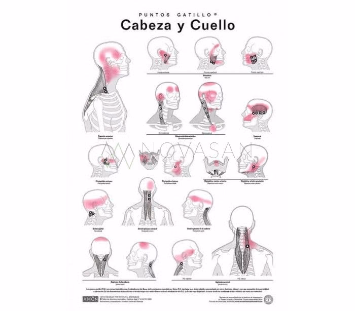 ¿Cómo liberar puntos gatillo?