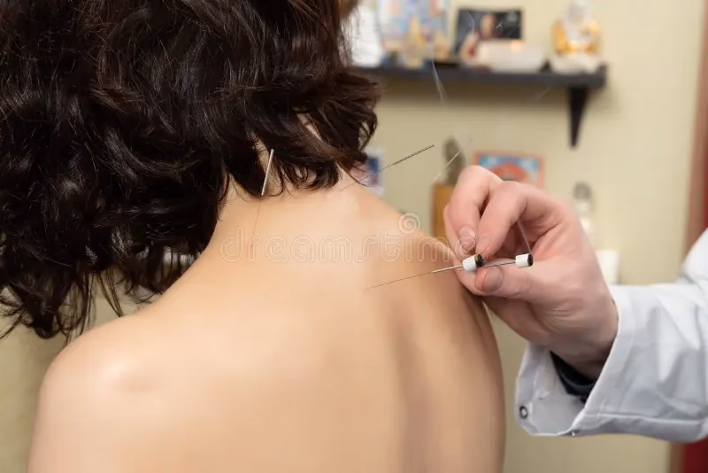 ¿Qué es la acupuntura tibetana?