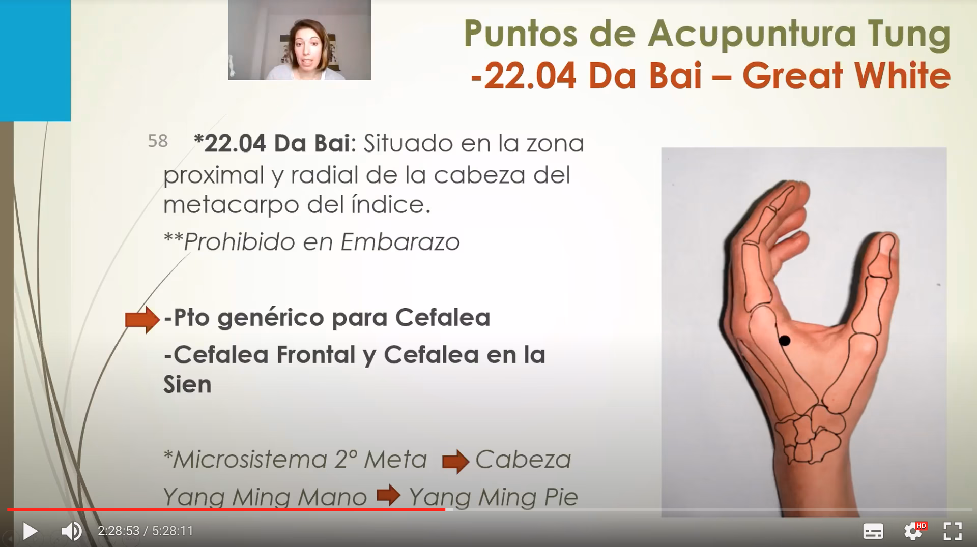 ¿Qué es el sistema de Tung?