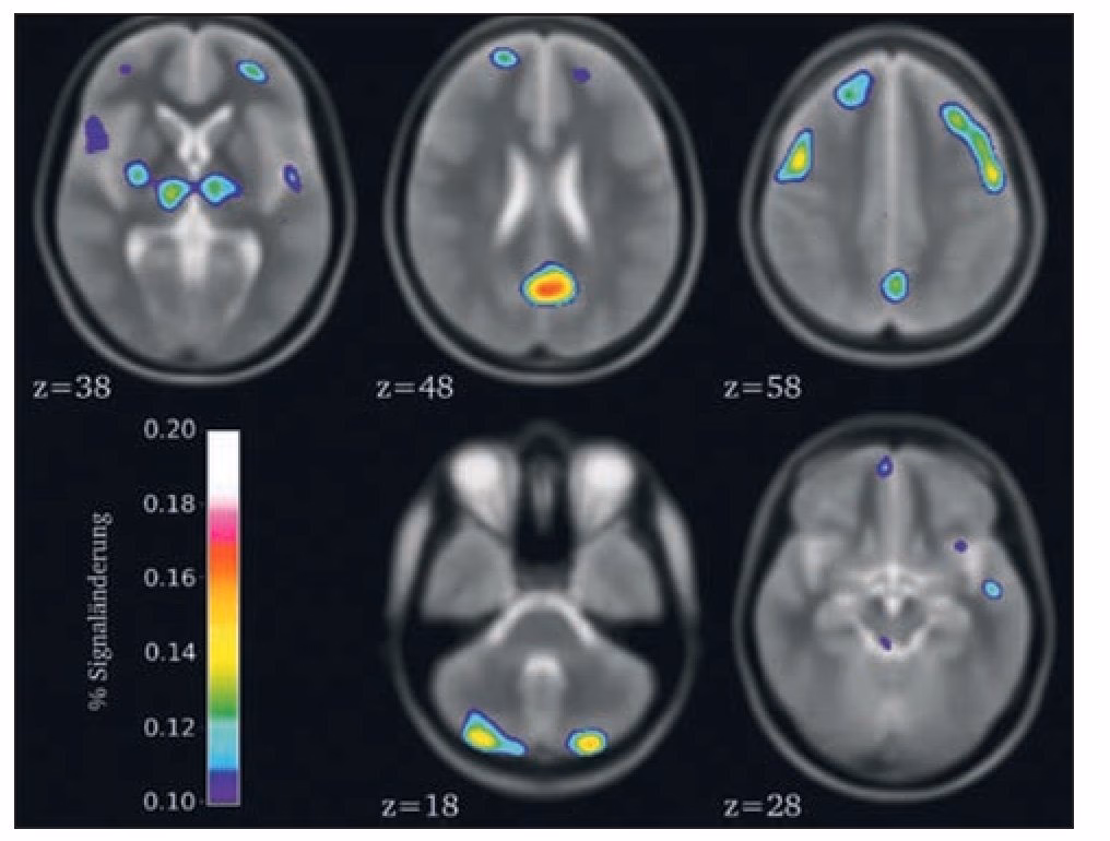 ¿Puede un acupunturista solicitar una resonancia magnética?