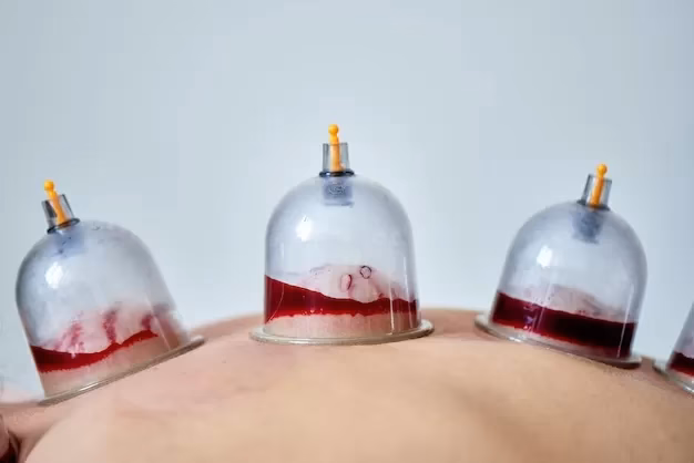 ¿Ventosa sangría beneficios?