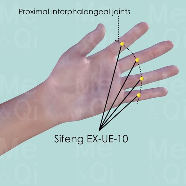 What is the Sifeng acupuncture point used for?