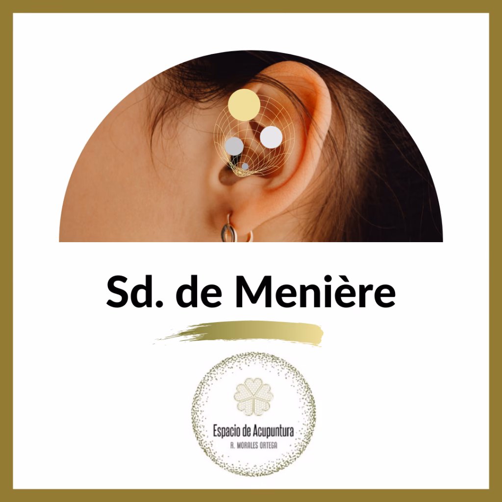 What is the root cause of Meniere's disease?