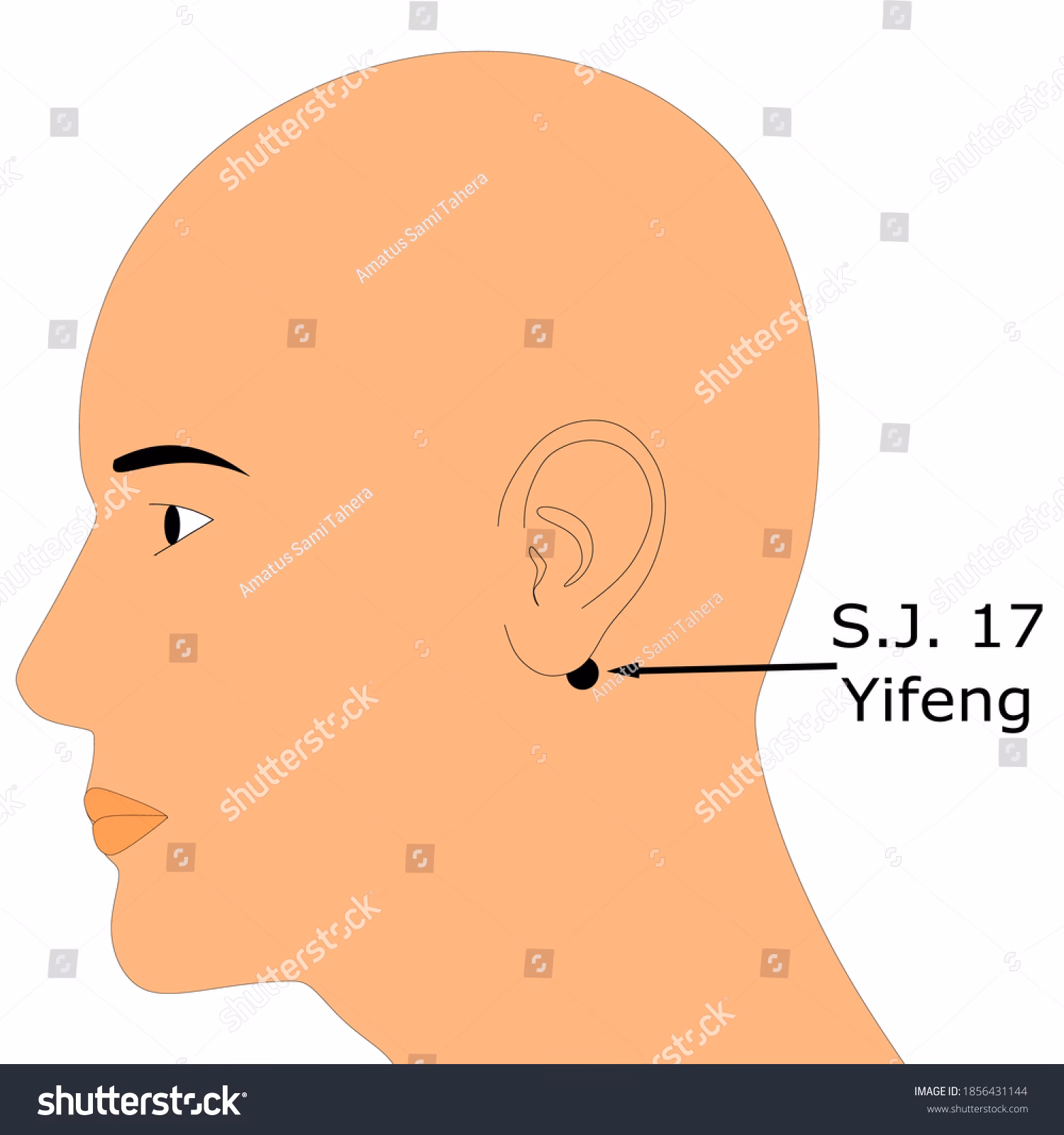 ¿Qué es SJ en acupuntura?