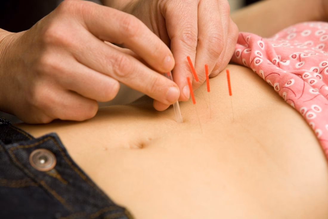 How long does fertility acupuncture last?