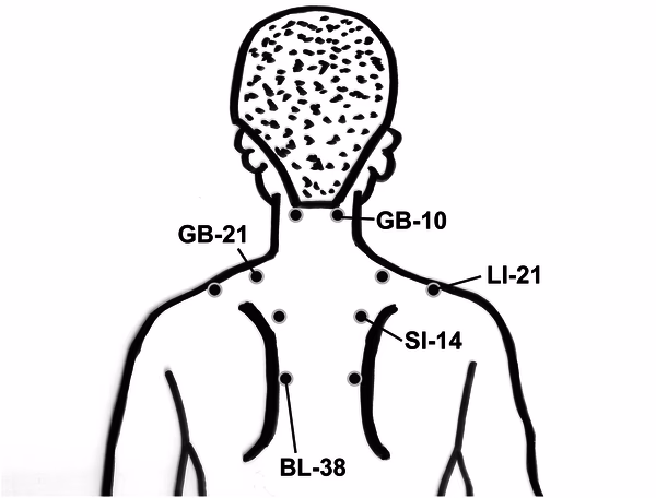 What are the acupuncture points for spine pain?