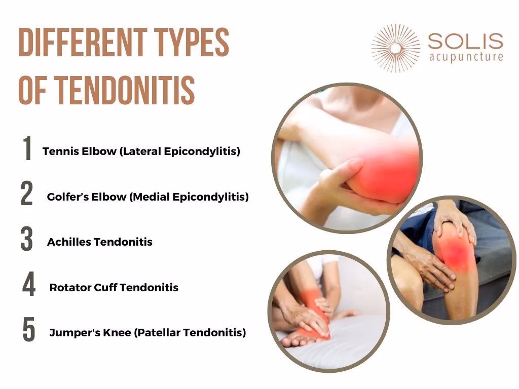 How is tendinitis treated?