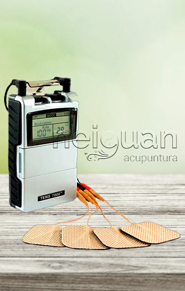 ¿Qué es la terapia TENS y para qué se utiliza?
