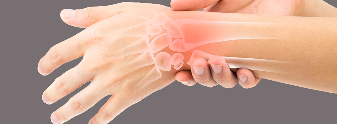 ¿Cómo puedo acelerar la recuperación de un esguince de muñeca?