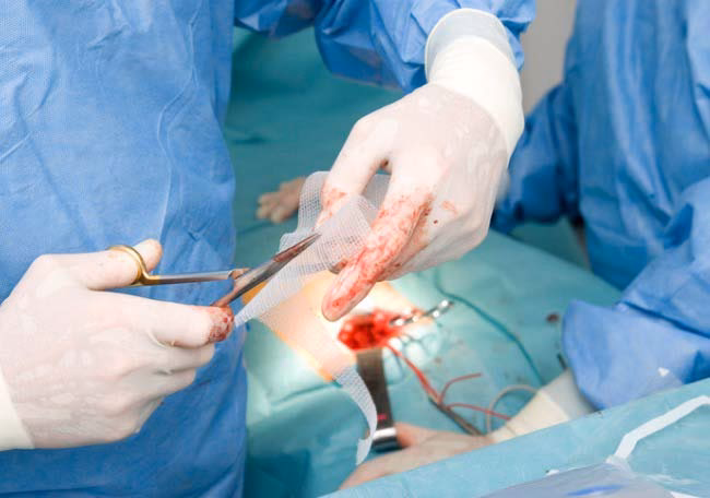 ¿Cómo se corrige una eventración?