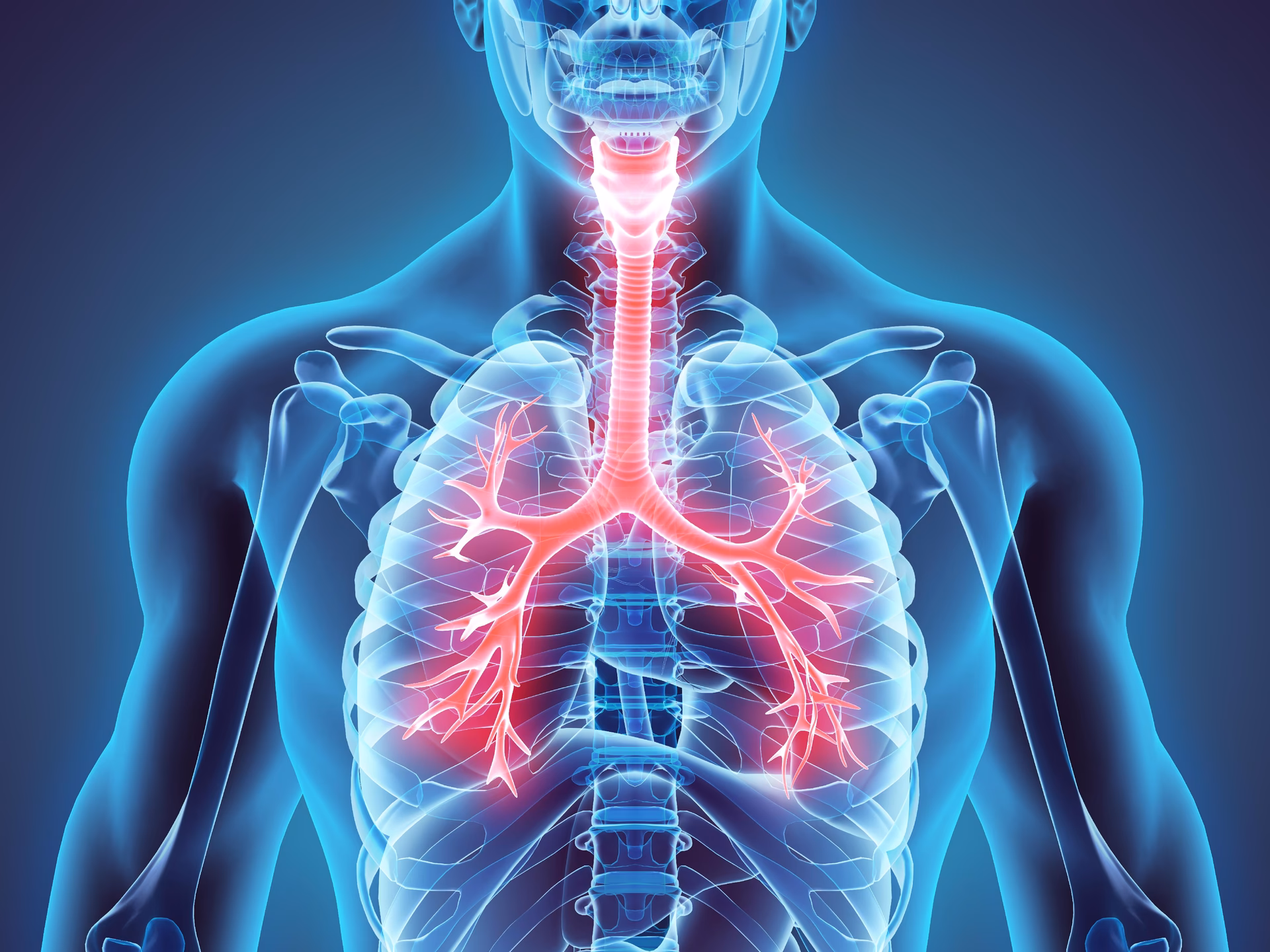 ¿Cuál es el fármaco de elección para la granulomatosis de Wegener?