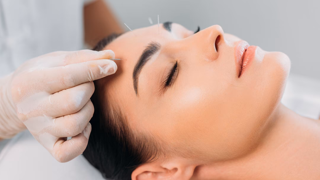 ¿Cuál es el mejor tratamiento para el líquen plano?