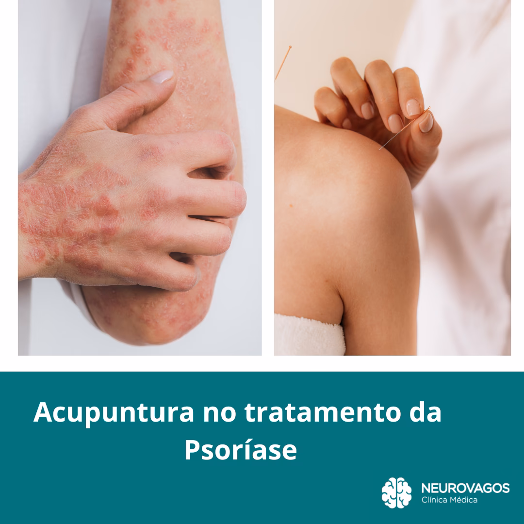 What is the best time to do acupuncture?