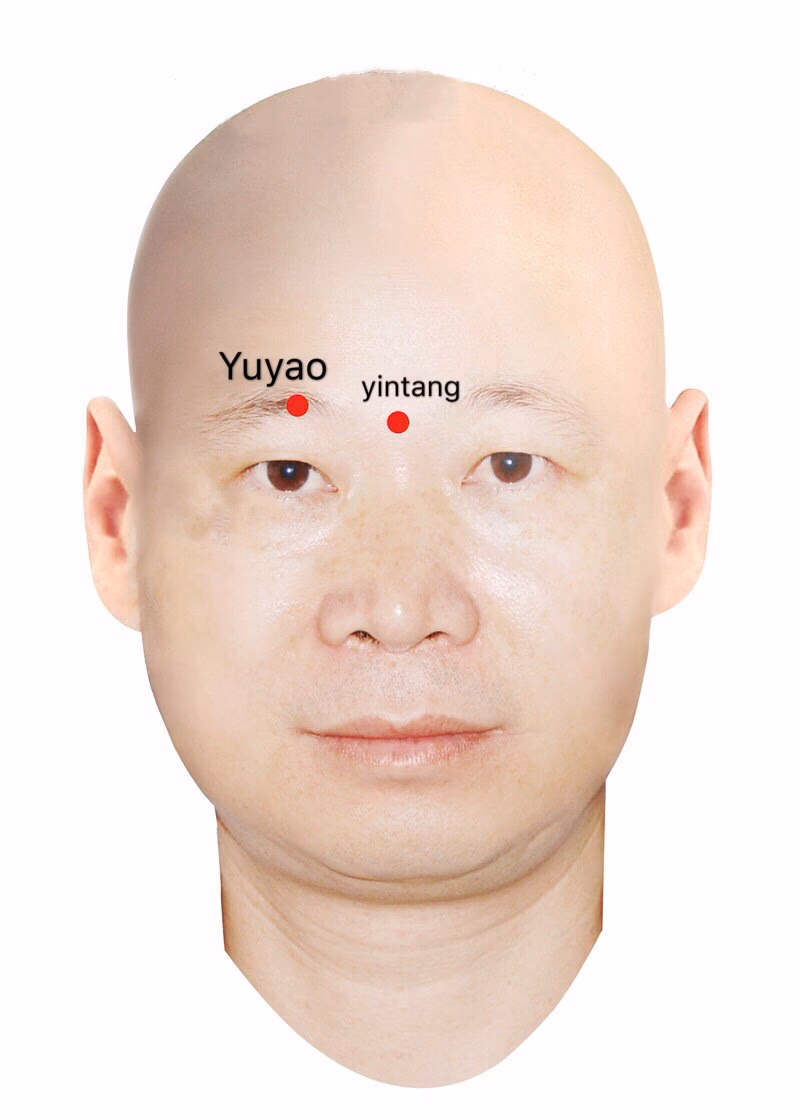 What is the Yu Yao acupressure point?